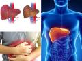 लिवर खराब होने के 8 लक्षण, अपनाएं ये 10 उपाय, लिवर फेल का खतरा होगा कम - Hindi News | Liver Failure Causes Symptoms and Treatment | Latest health Photos at Lokmatnews.in