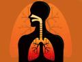 Lung Cancer Signs: ये हैं लंग कैंसर के 10 लक्षण, इन्हें कभी न करें नजरअंदाज, जानिए इनके बारे में - Hindi News | 10 early signs of lung cancer one should never ignore | Latest health News at Lokmatnews.in