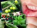 मुंह के छालों ने कर दिया है परेशान, तो इन चीजों से करें इलाज - Hindi News | Mouth ulcers home remedies treatment symptoms cure images photos and pictures | Latest health Photos at Lokmatnews.in