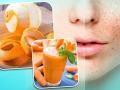 चेहरे पर दाग-धब्बे और पिंपल्स को दूर करेंगी ये 8 चीजें - Hindi News | skin care tips these herbs and foods get rid pimples pig mention acne dryness and pores | Latest health Photos at Lokmatnews.in