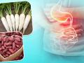 Health Tips: कब्ज और गैस से परेशान लोग बिल्कुल न खाएं ये 5 सब्जियां - Hindi News | vegetables and foods to avoid when constipated and gas do not eat these 5 vegetables | Latest health Photos at Lokmatnews.in