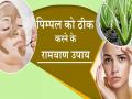 पिंपल, फोड़ा और फुंसी का जबरदस्त इलाज हैं ये 5 घरेलू नुस्खे, बिना किसी महंगे प्रोडक्ट के फ्री में ऐसे चमका सकते हैं चेहरा - Hindi News | 5 home made remedies boil pimple brighten face free without any expensive health product neem tulsi green tea | Latest health News at Lokmatnews.in