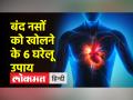 ये 6 उपाय बंद नसों को चुटकियों में खोल देंगे - Hindi News | These 6 remedies will open clogged veins in a jiffy | Latest health Videos at Lokmatnews.in