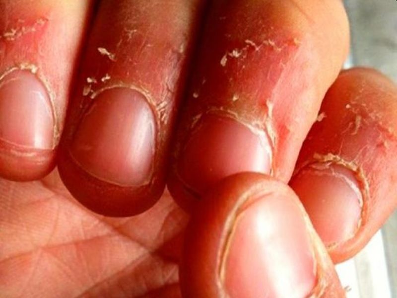 नाखून भी बता सकते हैं सेहत का हाल, जानिए कैसे मिलता है बीमारी का संकेत |  can your nails show signs of illness | HerZindagi
