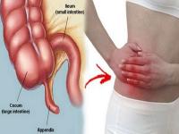 Appendicitis असहन य ह त ह प ट म अप ड क स फटन क दर द 8 लक षण स कर पहच न य 10 च ज द ल ए ग र हत