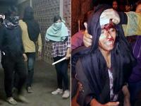 जेएनयू में पांच घंटे फैला रहा नकाबपोशों का कहर, देखिए खौफ और तनाव की तस्वीरें - | jnu image, jnu attack pictures, jnu violence ki photo, jnu university attack latest pics | Latest india Photos at Lokmatnews.in