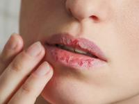 सर्दियों में इन 7 हरकतों की वजह से फटते हैं होंठ, तस्वीरें देख जानें - | Winter Tips: 7 Reasons behind chapped lips, view in pics | Latest fashion-beauty Photos at Lokmatnews.in