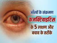 Eye Flu इंफेक्शन कंजक्टिवाइटिस के 5 लक्षण और बचाव के तरीके - | Eye Flu Treatment symptoms precautions and home remedies | Latest health Photos at Lokmatnews.in