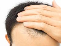 तस्वीरें: इन 7 चीजों के इस्तेमाल से होगी बालों की ग्रोथ दोगुनी | Pics: 7 Super Foods for Hair Growth everyone Should use in Daily diet | Latest food Photos at Lokmatnews.in