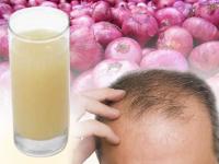 घने, लंबे, सॉफ्ट और सिल्की बाल पाने के लिए बस करें ये काम, जरूर होगा फायदा - | Hair Care Tips: Use egg Coconut Oil Onion Juice to get Long Healthy and Silky Hair | Latest fashion-beauty Photos at Lokmatnews.in