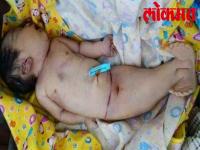 पैदा हुयी जलपरी डॉक्टर हो गए हैरान, देखिये वीडियो - | Mermaid born, doctors shocked: Watch video | Latest india Videos at Lokmatnews.in