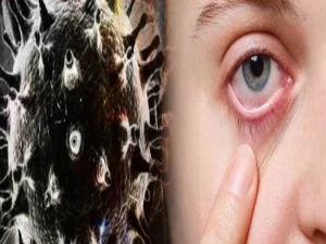 Can Non Covid Patients Get Black Fungus Here S What Experts Say English Lokmat Com