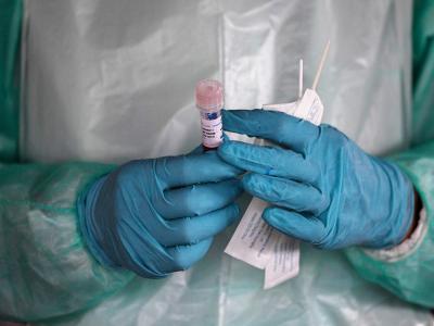 कोविड-19 से दोबारा संक्रमित होने दुनियाभर में अध्ययन का विषय है। (प्रतीकात्मक तस्वीर) कोविड-19 से दोबारा संक्रमित होने दुनियाभर में अध्ययन का विषय है। (प्रतीकात्मक तस्वीर)