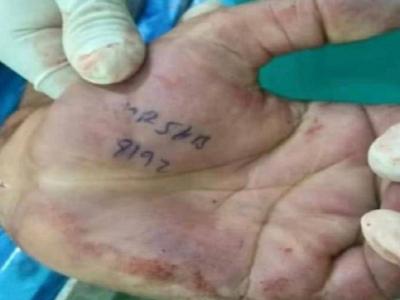 कानपुर शूटआउट में शहीद हुए पुलिस की हथेली पर लिखा मिला वाहन नंबर (तस्वीर स्त्रोत- India Today) कानपुर शूटआउट में शहीद हुए पुलिस की हथेली पर लिखा मिला वाहन नंबर (तस्वीर स्त्रोत- India Today)