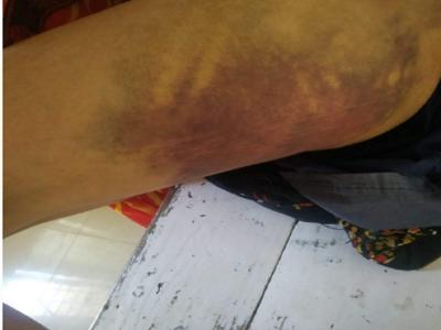 महिला के साथ प्रताड़ना