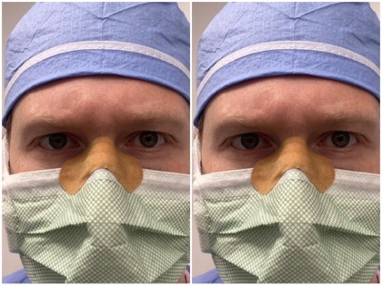 Coronavirus: How to avoid foggy glasses when wearing a face mask | Coronavirus: मास्क पहनने वालों के लिए डॉक्टर ने खोजा शानदार जुगाड़, अब नहीं जमेगा चश्मे पर फॉग