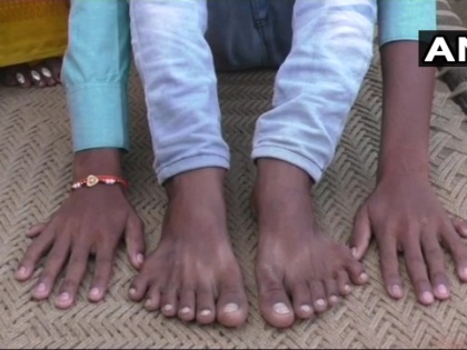 UP Barabanki boy with 12 fingers & 12 toes claim that relatives are trying to kill | हाथ और पैर में 12-12 उंगलियां, परिवार को सता रहा बलि का डर, जानें क्या है पूरा मामला