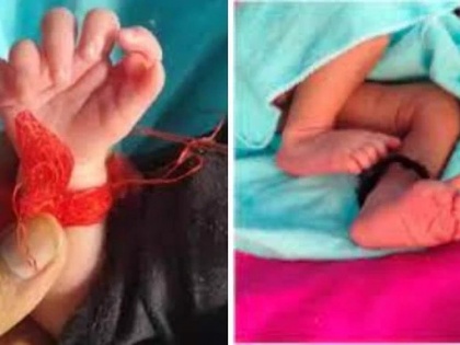 dig baby girl born total of 26 fingers seven each hand and six on each foot Bharatpur,Rajasthan  | कामांः कुल 26 उंगलियों वाली एक बच्ची का जन्म, दोनों हाथों में सात-सात और पैरों में छह-छह उंगलियां, जानें