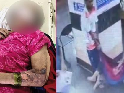 Mumbai Oh Kaliyuga cruel 33-year-old grandson left his 70-year-old grandmother suffering cancer forest near Aarey Colony woman found near garbage heap | हाय रे कलयुग?, कैंसर से पीड़ित 70 वर्षीय दादी को आरे कॉलोनी के पास जंगल में छोड़ आया निर्दयी 33 वर्षीय पोता, कूड़े के ढेर के पास मिली महिला