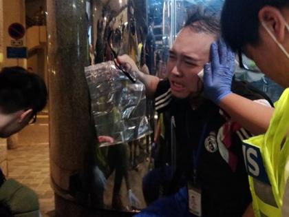 Man's ear partially bitten off during knife attack at Hong Kong mall | हांगकांग में हमलावर ने लोकतंत्र समर्थक नेता का कान चबाया, चाकू से हमले में 5 लोग घायल, दो की हालत बेहद नाजुक