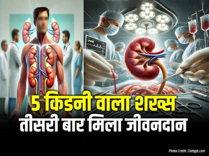 A Man with 5 Kidneys Get Life for the Third time, 47 Year Old Man | 5 किडनी वाला शख्स, तीसरी बार मिला जीवनदान, पढ़ें पूरी खबर