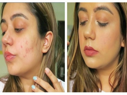 Juhi Parmar shares natural skincare hack to deal with pimples dark spots and oily skin | मुंहासों, फुंसियों और काले धब्बों से इस घरेलू नुस्खे के जरिए पाएं छुटकारा, जूही परमार ने शेयर किया वीडियो
