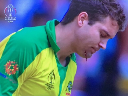 ICC World Cup 2019: Jofra Archer bouncer stuck Alex Carey on head, he got a cut on his chin, Watch Video | AUS vs ENG: जोफ्रा आर्चर की घातक गेंद ने उड़ाया ऑस्ट्रेलियाई बल्लेबाज का हेलमेट, निकला ठुड्डी से खून, देखें वीडियो