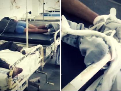 Patients are being treated after being tied up to bed in AMU'S NEHRU MEDICAL college picture go viral | AMU के नेहरू मेडिकल कॉलेज में मरीजों को बेड से बांधकर हो रहा इलाज, वायरल हुई तस्वीरें