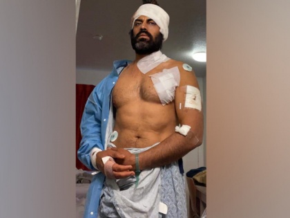 Punjabi actor Aman Dhaliwala attacked by accused with an ax while working out in the gym in America | पंजाबी एक्टर अमन धालीवाल पर अमेरिका में हुआ जानलेवा हमला, आरोपी ने कुल्हाड़ी से वार कर एक्टर को किया खून से लथपथ