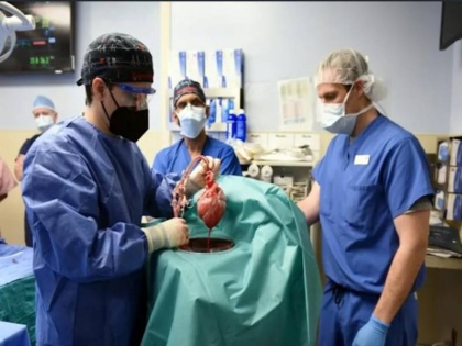 US surgeons successfully implanted a pig heart in a human | सर्जनों ने किया ऐतिहासिक ट्रांसप्लांट, इंसान के शरीर में लगाया सूअर का दिल