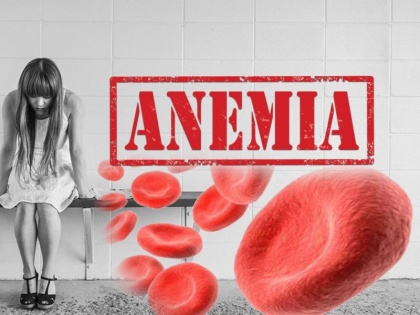 Blog: Anemia needs to be taken seriously for malnutrition free India, instead of decreasing it is increasing | ब्लॉग: कुपोषणमुक्त भारत के लिए एनीमिया को पूरी गंभीरता से लेने की जरूरत, घटने के बजाय बढ़ता ही जा रहा