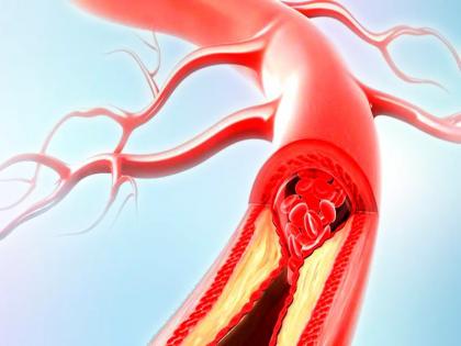 खून की कमी से होने वाले नुकसान, स्वस्थ शरीर में कितना खून होना चाहिए, तेजी से खून की कमी को पूरा करेंगी ये 8 चीजें