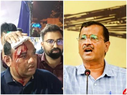 aap says gujarat leader attacked by bjp goons arvind Kejriwal asks CM to act | आप का दावा- 'भाजपा के गुंडों ने गुजरात के जनरल सेक्रेटरी पर जानलेवा हमला किया', केजरीवाल ने कहा- गुजरात सीएम कार्रवाई करें aap says gujarat leader attacked by bjp goons arvind Kejriwal asks CM to act | आप का दावा- 'भाजपा के गुंडों ने गुजरात के जनरल सेक्रेटरी पर जानलेवा हमला किया', केजरीवाल ने कहा- गुजरात सीएम कार्रवाई करें