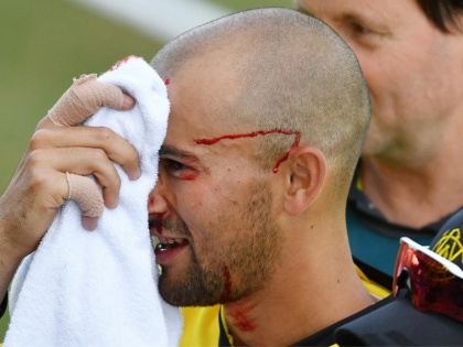 Australian cricketer Ashton Agar suffers gruesome injury after dropping brother Wes Agar's catch | भाई का कैच लपकने की कोशिश में ऑस्ट्रेलियाई क्रिकेटर के नाक पर लगी चोट, हुआ लहूलुहान