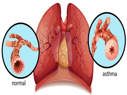 Ayurvedic Remedies For Asthma: Try these 5 herbs, asthma will go away instantly | Ayurvedic Remedies For Asthma: इन 5 जड़ी-बूटियों को आजमाकर देखें, छू मंतर हो जाएगा अस्थमा