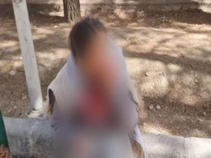Attack little girl's Sara Shirazi face not wearing hijab Iran attacker Razieh Haft Bradaran bled her face see photo-video | ईरान: हिजाब नहीं पहनने पर छोटी बच्ची के मुंह पर हमला, हमलावरों ने चेहरे को किया लहूलुहान, देखें फोटो-वीडियो