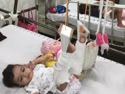 11 month old girl leg fractured, doctors done treatment with help of doll at lok nayak hospital | नन्ही बच्ची का फ्रैक्चर हुआ पैर तो अपनी गुड़िया को भी चढ़वाया प्लास्टर, सोशल मीडिया पर लोगों ने की तारीफ!