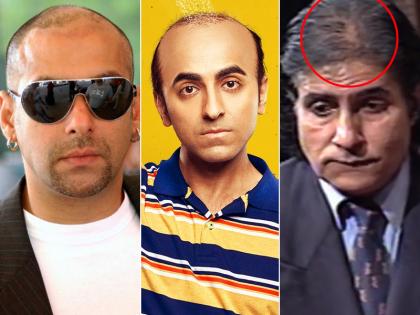 फिल्मी लाइफ में 'बाला' लेकिन रियल लाइफ में इन बॉलीवुड स्टार्स को है बालों की समस्या, करवाना पड़ा था हेयर ट्रांसप्लांट