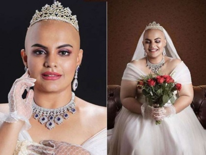 Akhshaya Navaneethan plus size model went bald for a bridal shoot | Bald & Bold Bride: मॉडल ने कराया बिना बालों के ब्राइडल फोटोशूट, देखकर आप भी हो जाएंगे फैन