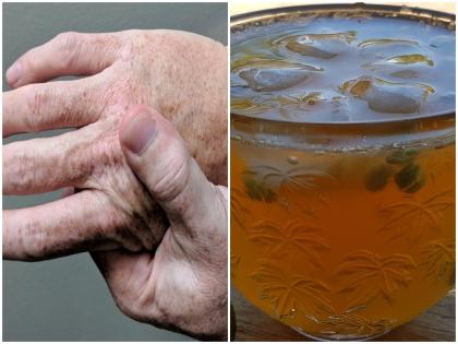 aak leaves best for joint pain solution know three ways to use it health tips in hindi | जोड़ों के दर्द को हमेशा के लिए करना है छूमंतर तो आज ही अपनाए आक की पत्तियों को, जानें Joint Pain के रामबाण इलाज के 3 अलग-अलग इस्तेमाल करने के तरीके