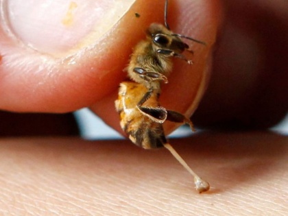home remedies for bees and Wasp bite : medical treatment and first for bees and Wasp bite | ततैया य मधुमक्खी के काटने पर तुरंत करें 7 काम, नहीं फैलेगा जहर, दर्द, सूजन, बुखार से मिलेगी राहत