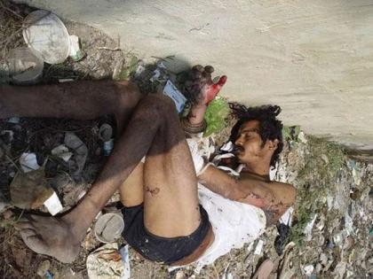 patient thrown into a garbage in bihar | इलाज के बदले मरीज को कूड़े के ढेर पर फेंका, खबर वायरल होने के बाद उठाया ये कदम patient thrown into a garbage in bihar | इलाज के बदले मरीज को कूड़े के ढेर पर फेंका, खबर वायरल होने के बाद उठाया ये कदम