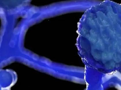 Jammu Kashmir amid coronavirus now black fungus first case detected | जम्मू-कश्मीर में कोरोना के कहर के बीच अब ब्लैक फंगस की दस्तक, मिला पहला मरीज Jammu Kashmir amid coronavirus now black fungus first case detected | जम्मू-कश्मीर में कोरोना के कहर के बीच अब ब्लैक फंगस की दस्तक, मिला पहला मरीज