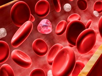 How Much Blood is in your body iron deficiency symptoms iron rich foods to beat anemia in hindi | शरीर में कितना खून होना चाहिए ? खून बढ़ाने के लिए खायें ये 8 चीजें