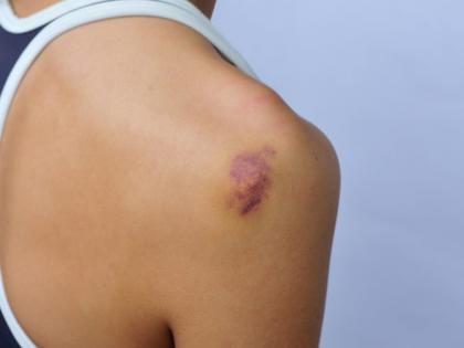 early sign and symptoms of Leukemia or blood cancer, foods to prevent blood cancer, blood cancer types, risk factors, treatment, prevention in Hindi | ब्लड कैंसर होने से पहले शरीर देता है ये 16 चेतावनी, तुरंत खाना शुरू कर दें ये 10 चीजें early sign and symptoms of Leukemia or blood cancer, foods to prevent blood cancer, blood cancer types, risk factors, treatment, prevention in Hindi | ब्लड कैंसर होने से पहले शरीर देता है ये 16 चेतावनी, तुरंत खाना शुरू कर दें ये 10 चीजें