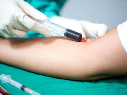 Blood Culture Test: what is Blood Culture Test, Purpose, Procedure, Results and risk in Hindi | Blood Culture Test: खून में संक्रमण की जांच के लिए जरूरी है ब्लड कल्चर टेस्ट, जानें किन लोगों को और क्यों है इसकी जरूरत