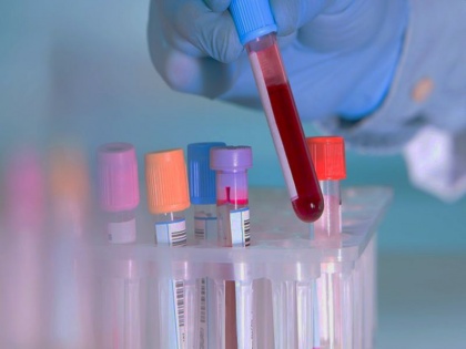 IIT Kharagpur researchers make low-cost blood test device for blood test | इस खास डिवाइस के जरिए सिर्फ 1 रुपये में हो सकेगा ब्लड टेस्ट