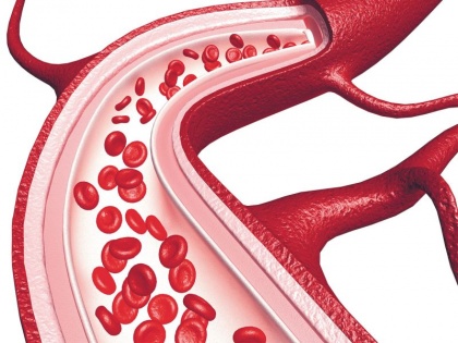 early sign and symptoms of blockage arteries or vessels, tips to keep nerves healthy and strong naturally | Health tips: नसों में गंदगी जमा होने और कमजोर होने पर शरीर देता है ये 10 चेतावनी, तुरंत खाना शुरू करें ये 6 चीजें