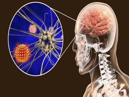 Coronavirus effects: study says covid-19 attacks on the brain, know how Covid-19 attacks the brain in Hindi | Coronavirus effects: वैज्ञानिकों का दावा, दिमाग पर भी अटैक कर रहा है कोरोना, चूस लेता है कोशिकाओं का ऑक्सीजन