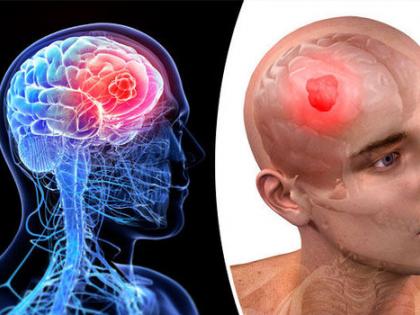 Chronic insomniacs show decline in memory thinking abilities compared deep sleepers 2750 people monitored average o5 and a half years | गहरी नींद में सोने वाले की तुलना में लंबे समय से अनिद्रा का शिकार लोगों की याददाश्त-सोचने की क्षमता में गिरावट, 2750 लोग पर औसतन साढ़े पांच साल तक नजर